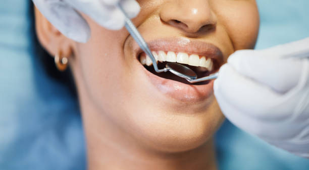 Best Emergency Broken Tooth Repair in La Center, WA