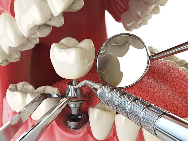 Best Emergency Treatment for Toothache in La Center, WA