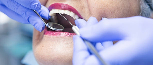 Best Emergency Tooth Extraction in La Center, WA